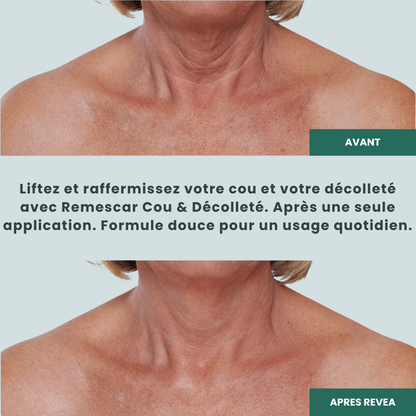 Revea - Crema rassodante collo e décolleté - Formula nordica - 75 ml